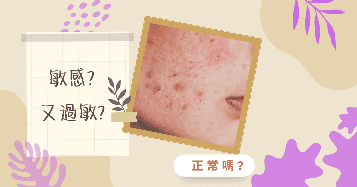 敏感肌膚治療方法有哪些