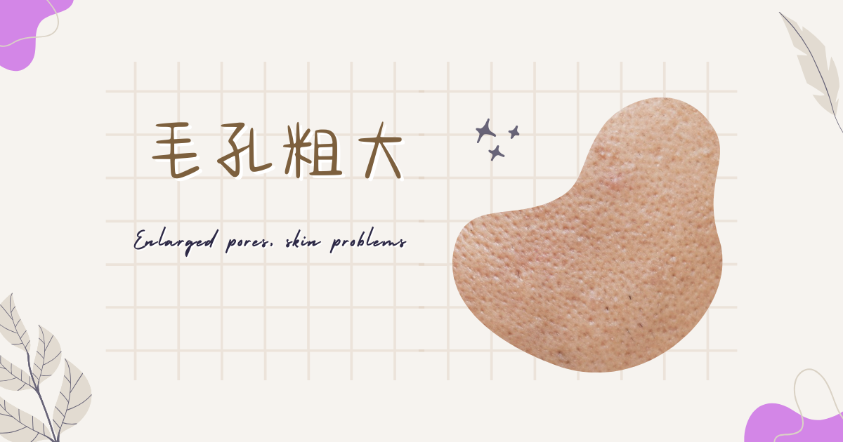 毛孔粗大會變小的方法