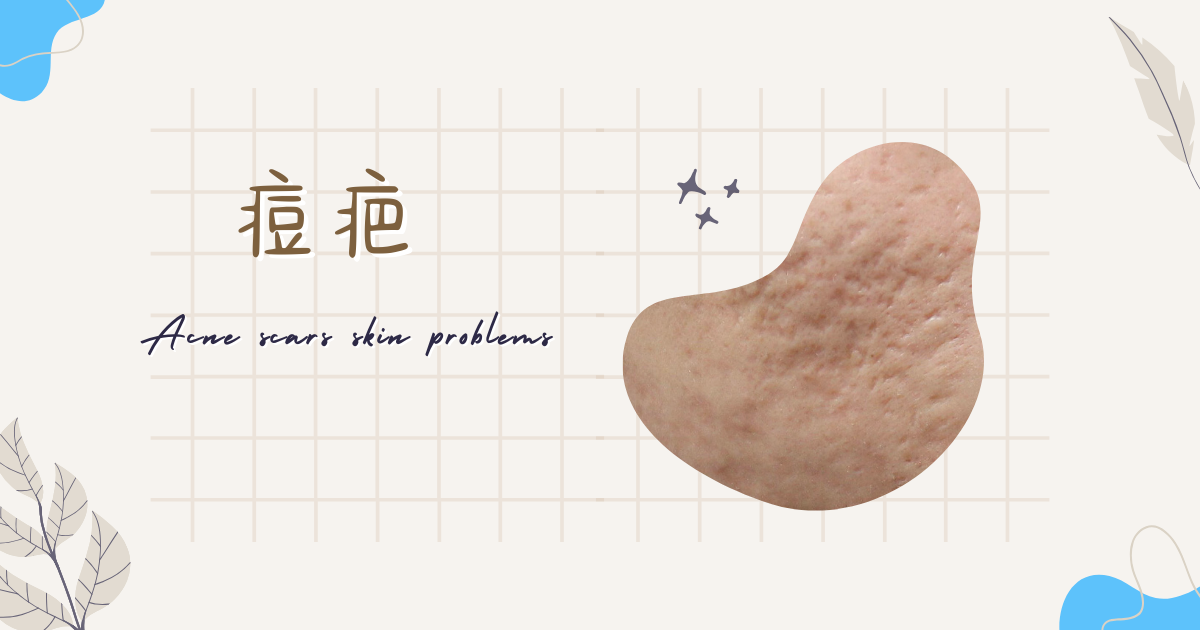 痘疤很大會不見嗎