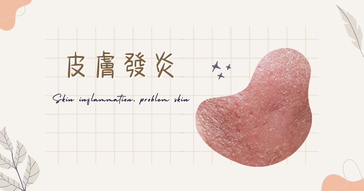 皮膚發炎找醫生還是美容