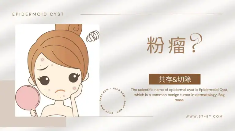 epidermoid cyst explanation Illustration explaining what an epidermoid cyst is, featuring a worried girl with facial bumps and the question "粉瘤?"