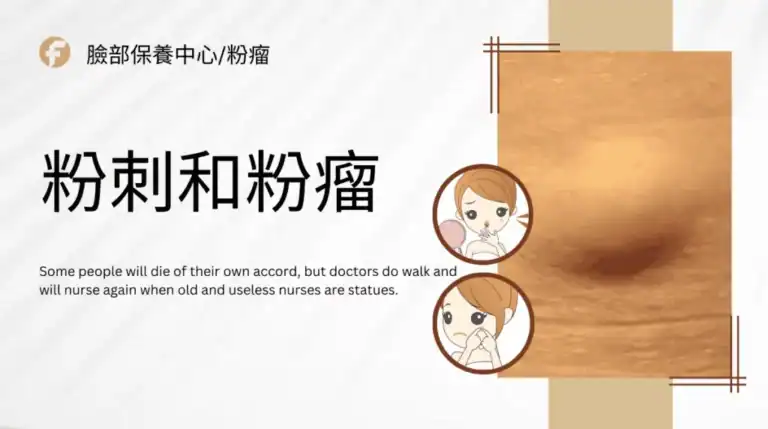epidermoid cyst vs acne difference Illustration comparing epidermoid cyst (粉瘤) and acne (粉刺) with visual differences in skin texture and symptoms.