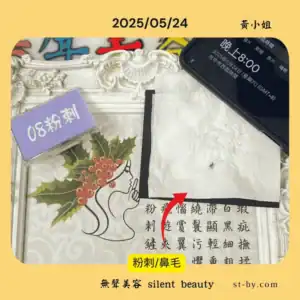 2025 05 24 acne whiteheads 08 night cleansing