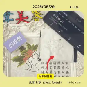 2025 05 29 王小姐 08粉刺保養