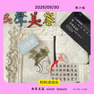 2025年5月30日下午5點20分清理粉刺紀錄，課程為緊緻類第04類，清理後膚況穩定無紅腫，屬無聲美容粉刺牆系列。