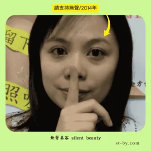 bright eyes direct silent