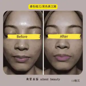 dull skin dark pigment clearing