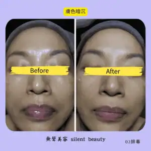 dull skin tone clear before after