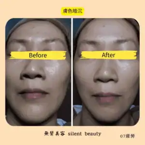 dull skin tone correction 07