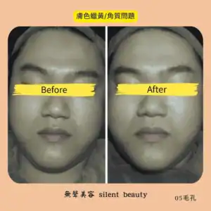 dull yellow skin keratin issue 05