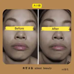 facial slimming visible change 10