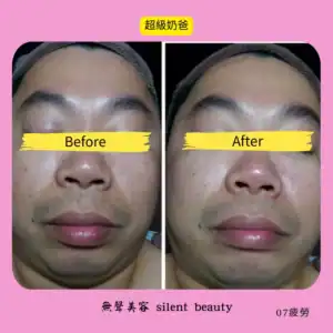 fatigue release super dad treatment 07