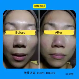 fatigue relief sleep reset effect 07