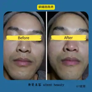 fatigue relief stylish man result 07