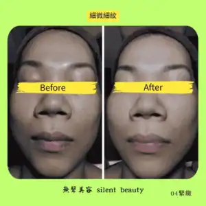 fine lines tightening facial care