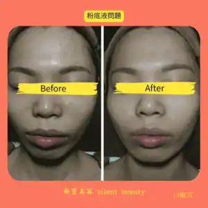 foundation issue dark spots clearing