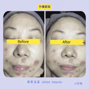 hand scratch sensitive soothe change