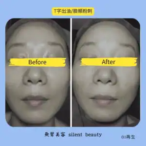 large pores keratin treatment 08