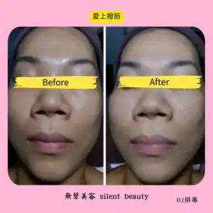 love temple muscle toning facial lift 02