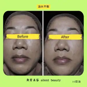 oil water balance skincare result 14