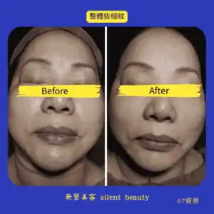 overall fine lines fatigue improvement