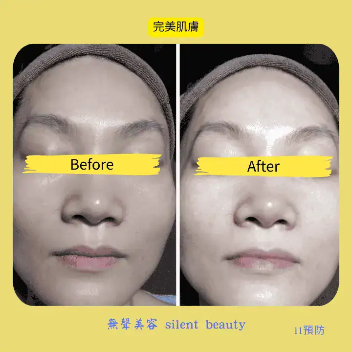 perfect skin prevent care visible effect