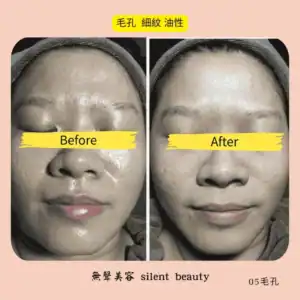 pore oil line matte recorded