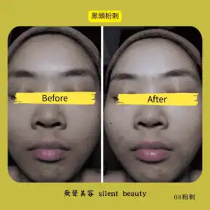pores shrink true record.webp