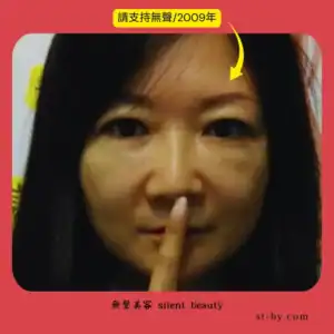 quiet glance support