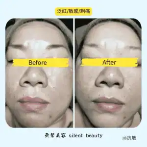 redness stinging sensitive skin soothing