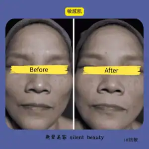 sensitive skin calmed gentle result