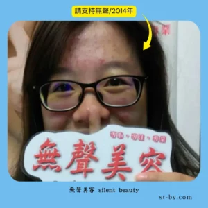 silent beauty 2014 support bright