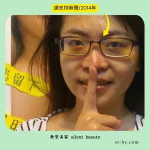 silent beauty 2014 support focus