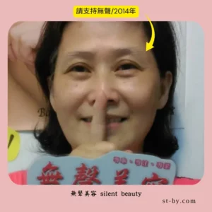 silent beauty 2014 support trust