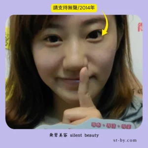 silent beauty 2014 support young