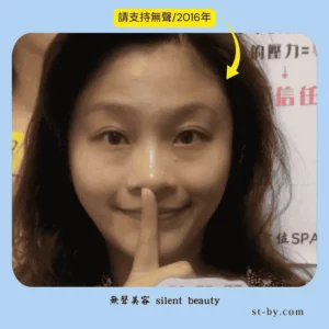 silent beauty natural smile 2016