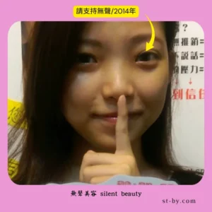 silent beauty support 2014 smile