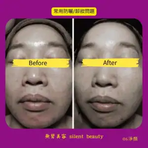 sunscreen irritation makeup removal cleanse