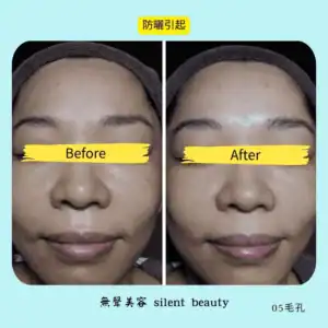 sunscreen reaction improve true record