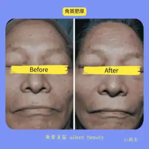 thick keratin renewal skinproof