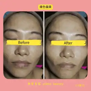 yellow skin tone brightening