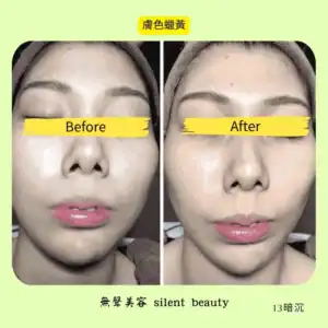 yellowish skin tone brightening 13
