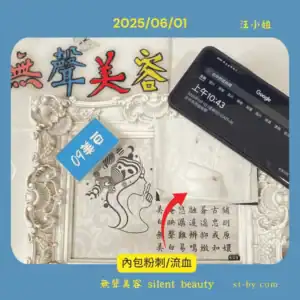內包粉刺造成流血記錄，無聲美容保留每一次清除真實過程，無過度包裝。
