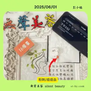 粉刺與痘痘處理後出血的實況紀錄，強調無聲美容真實透明的療程結果。