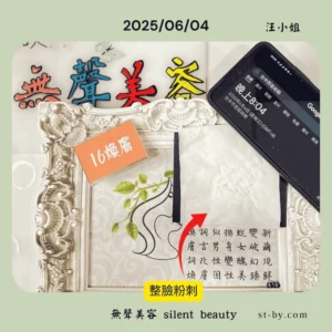 臉部粉刺清理後的實際紀錄，搭配煥膚課程，汪小姐 6 月 4 日紀錄照