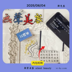 內包型粉刺與油脂問題處理後照片，鄭先生 6/4 控油課程實例
