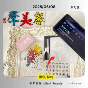 2025/06/08 pore blackhead whitehead removal pore cleansing technique
