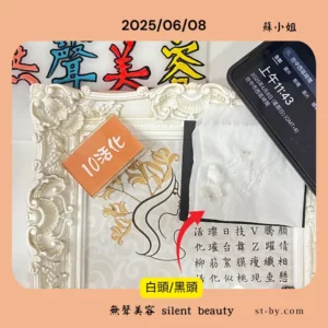 2025/06/08 revitalize course blackhead whitehead cleansing pore care